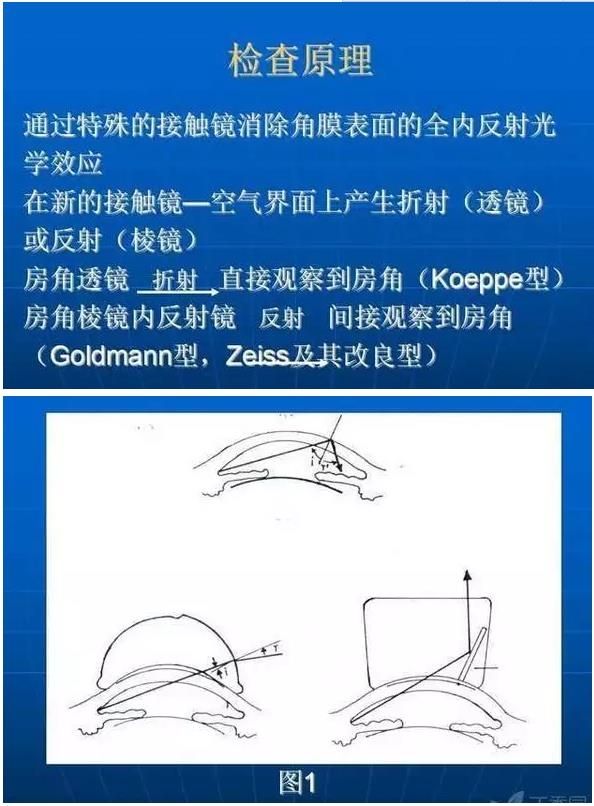 ǰ���Ǿ����Ĳ�������