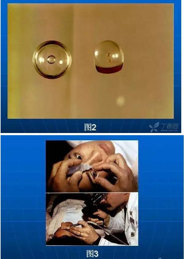 ǰ���Ǿ����Ĳ�������