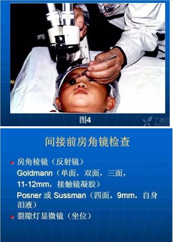 ǰ���Ǿ����Ĳ�������