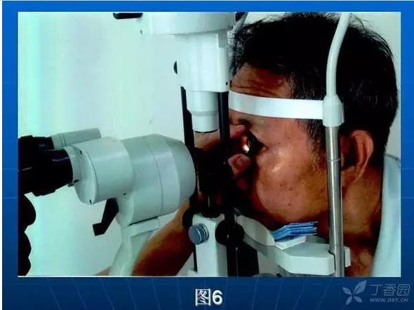 ǰ���Ǿ����Ĳ�������