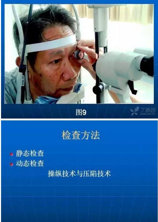 ǰ���Ǿ����Ĳ�������