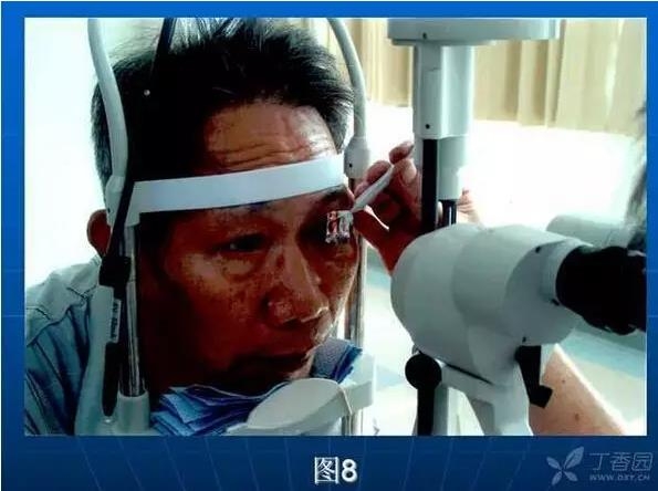 ǰ���Ǿ����Ĳ�������