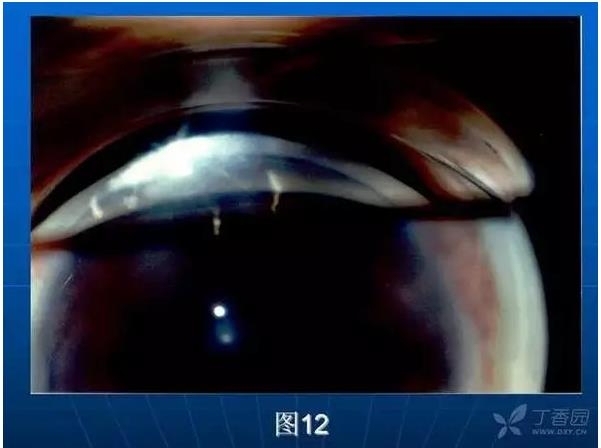 ǰ���Ǿ����Ĳ�������