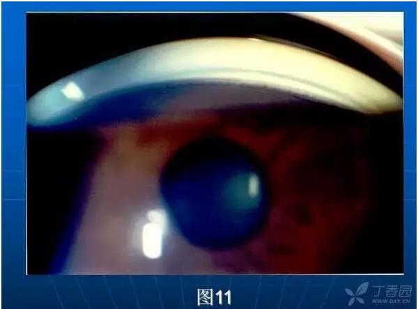 ǰ���Ǿ����Ĳ�������