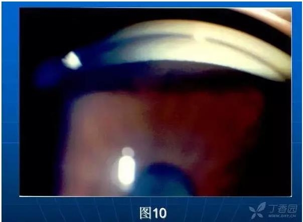 ǰ���Ǿ����Ĳ�������