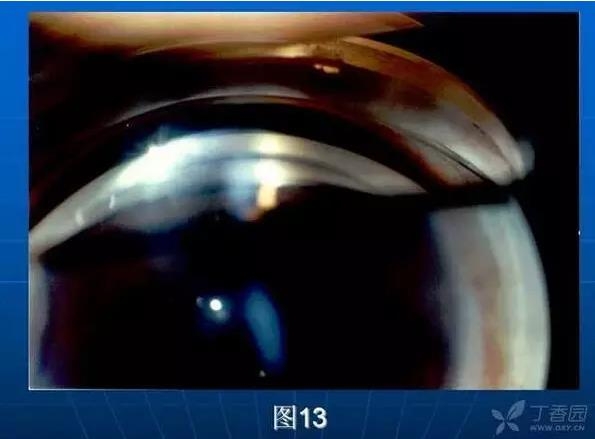 ǰ���Ǿ����Ĳ�������