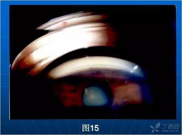 ǰ���Ǿ����Ĳ�������