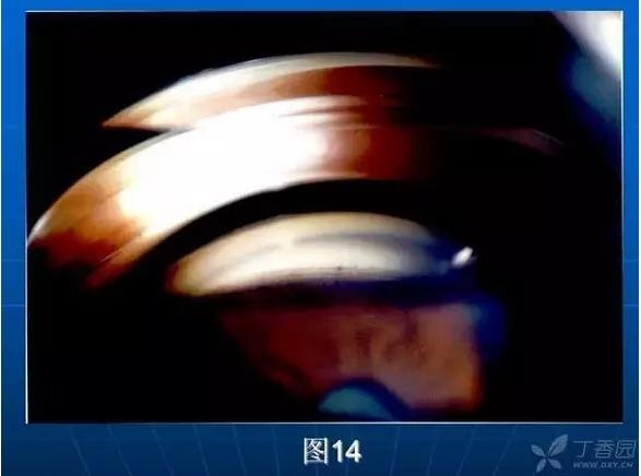 ǰ���Ǿ����Ĳ�������