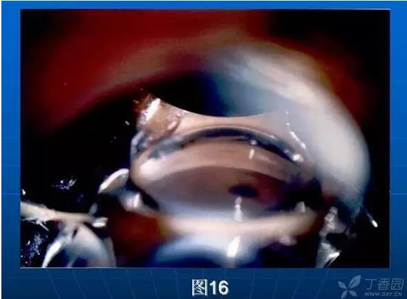 ǰ���Ǿ����Ĳ�������