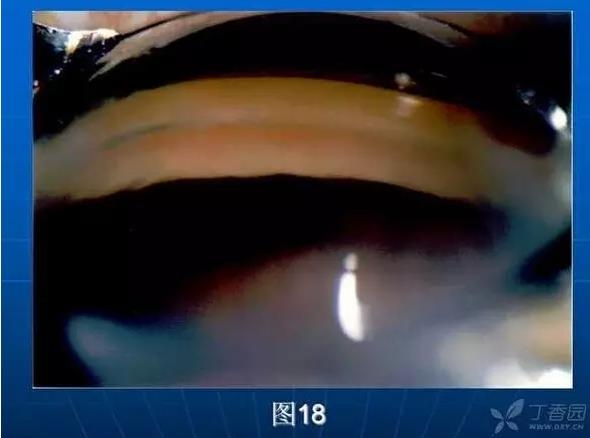 ǰ���Ǿ����Ĳ�������