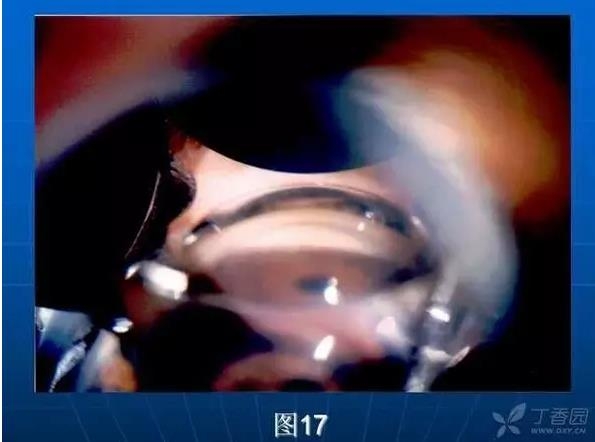 ǰ���Ǿ����Ĳ�������