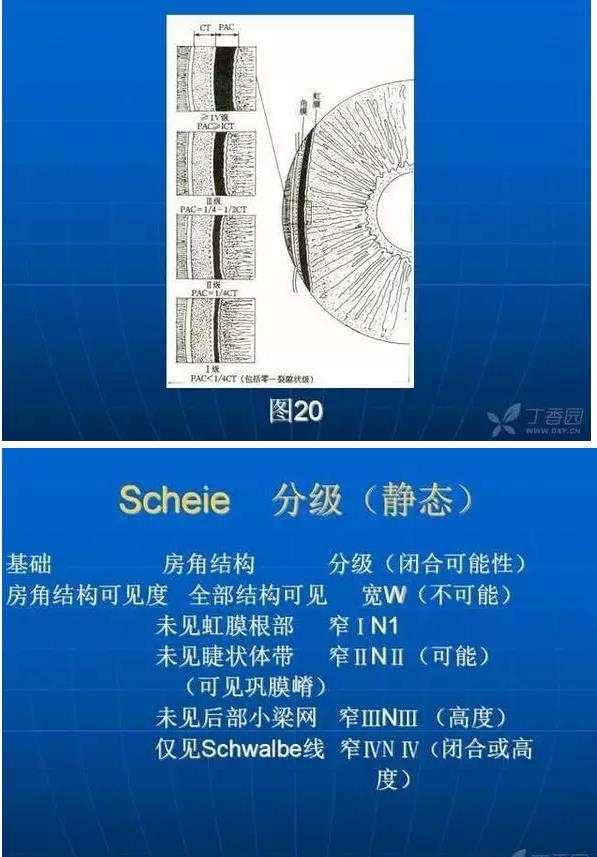 ǰ���Ǿ����Ĳ�������