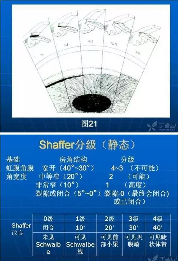 ǰ���Ǿ����Ĳ�������