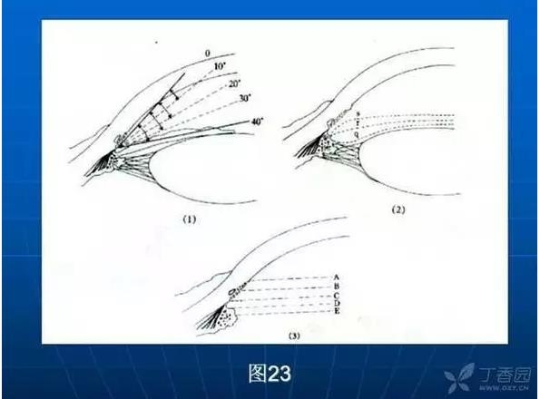 ǰ���Ǿ����Ĳ�������