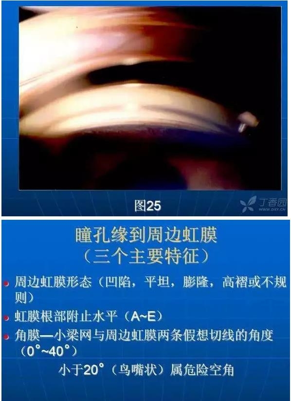 ǰ���Ǿ����Ĳ�������