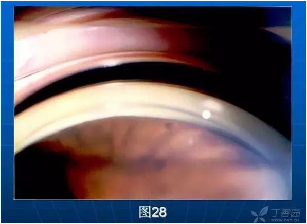 ǰ���Ǿ����Ĳ�������