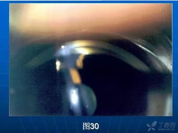 ǰ���Ǿ����Ĳ�������