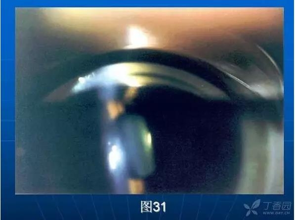 ǰ���Ǿ����Ĳ�������