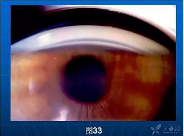 ǰ���Ǿ����Ĳ�������