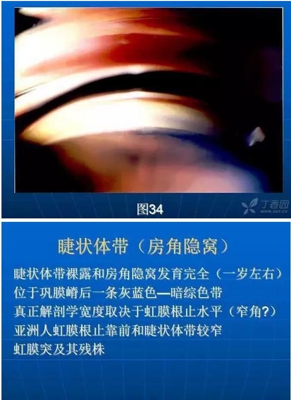 ǰ���Ǿ����Ĳ�������