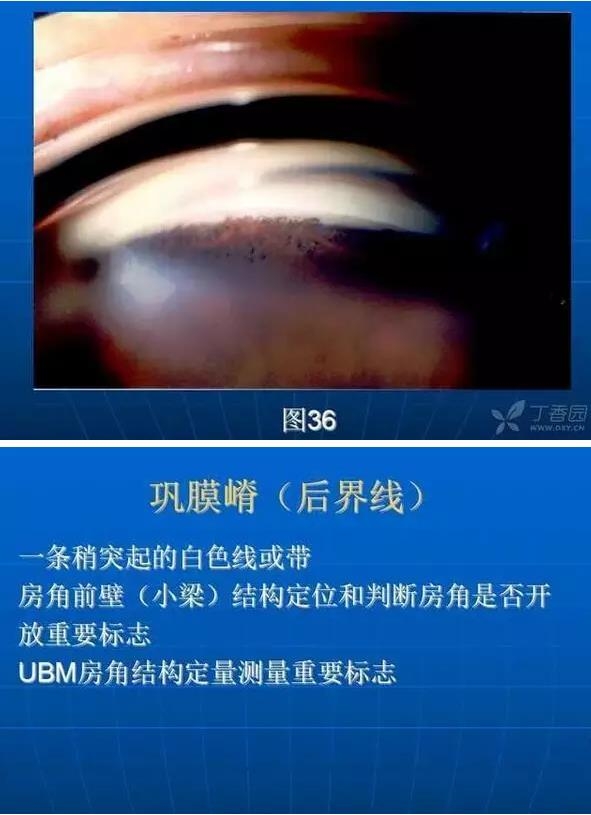 ǰ���Ǿ����Ĳ�������