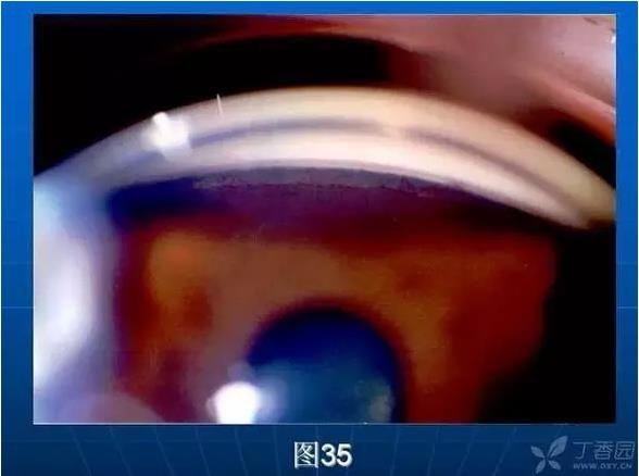 ǰ���Ǿ����Ĳ�������