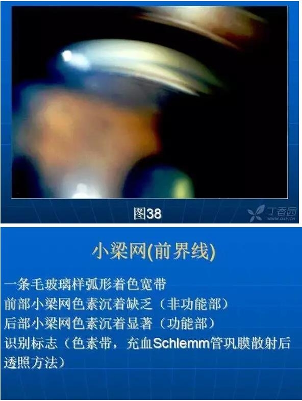 ǰ���Ǿ����Ĳ�������