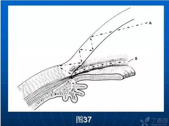 ǰ���Ǿ����Ĳ�������