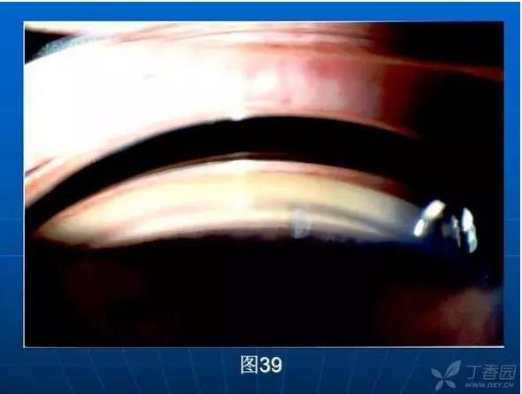 ǰ���Ǿ����Ĳ�������