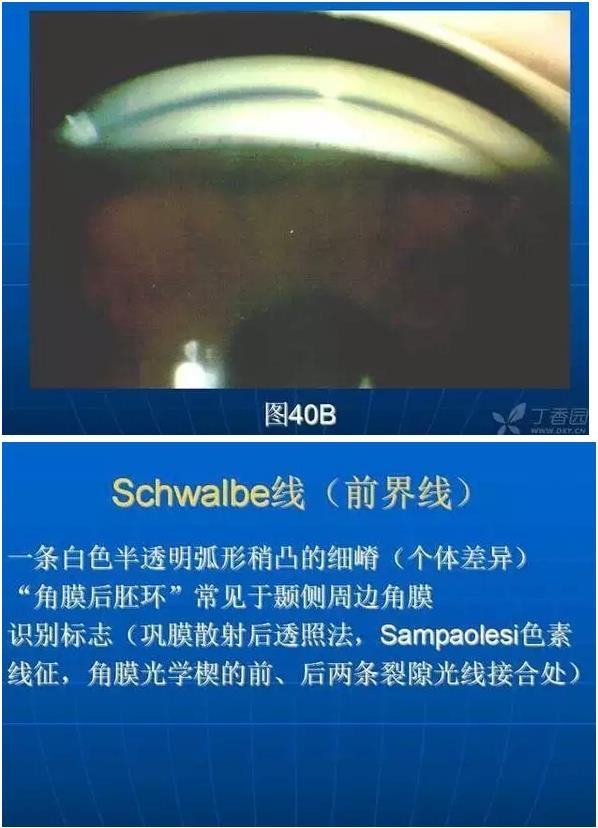 ǰ���Ǿ����Ĳ�������