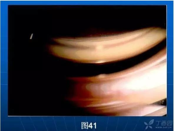 ǰ���Ǿ����Ĳ�������