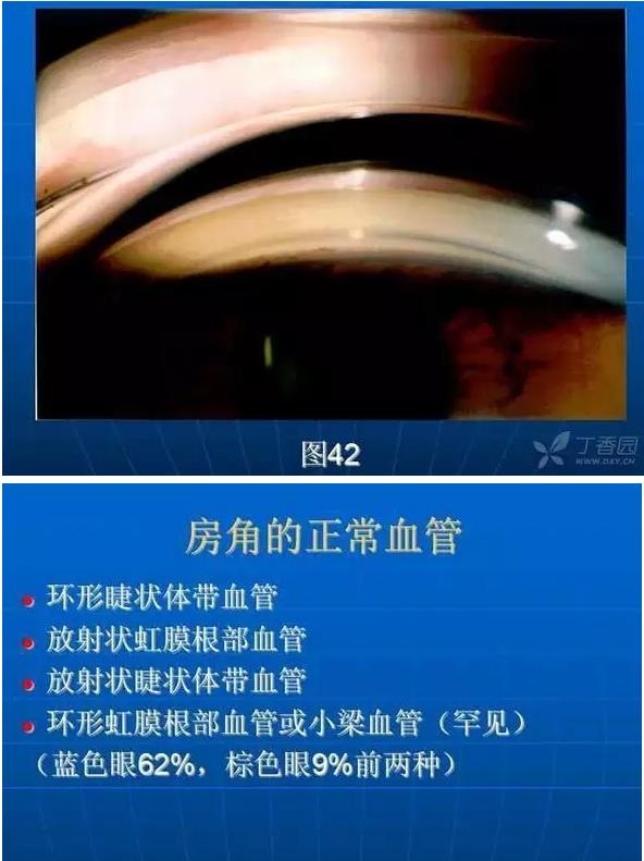 ǰ���Ǿ����Ĳ�������