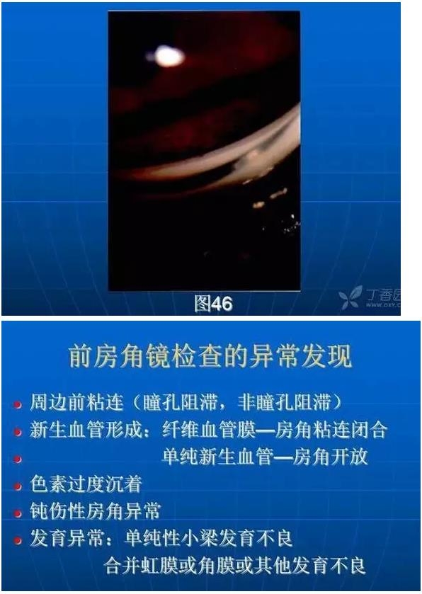 ǰ���Ǿ����Ĳ�������