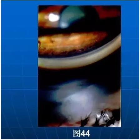 ǰ���Ǿ����Ĳ�������