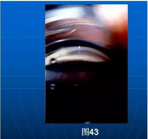 ǰ���Ǿ����Ĳ�������