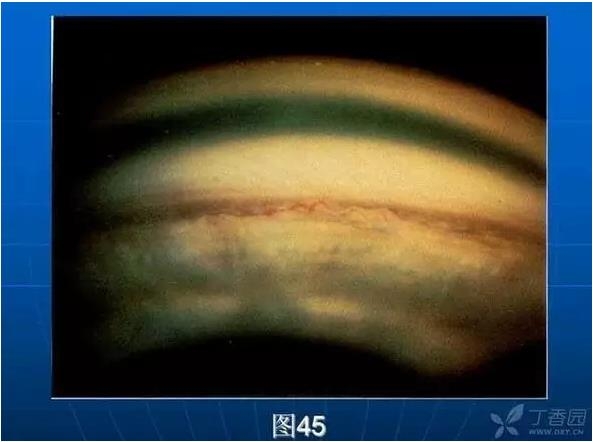 ǰ���Ǿ����Ĳ�������