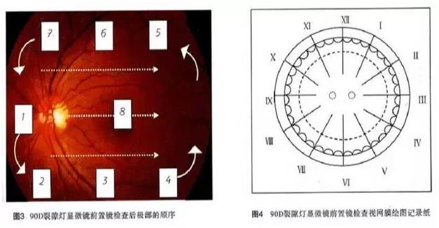 ��϶�ơ�volk�������۾����ܼ��ʹ�÷���