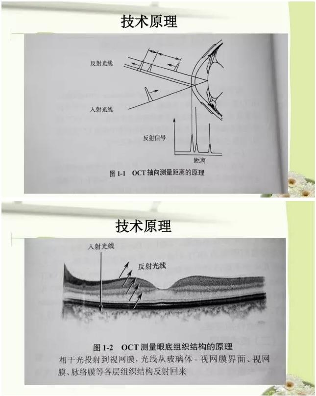 OCT����֪ʶ������֪���Ķ�������