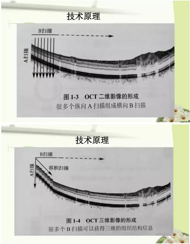 OCT����֪ʶ������֪���Ķ�������