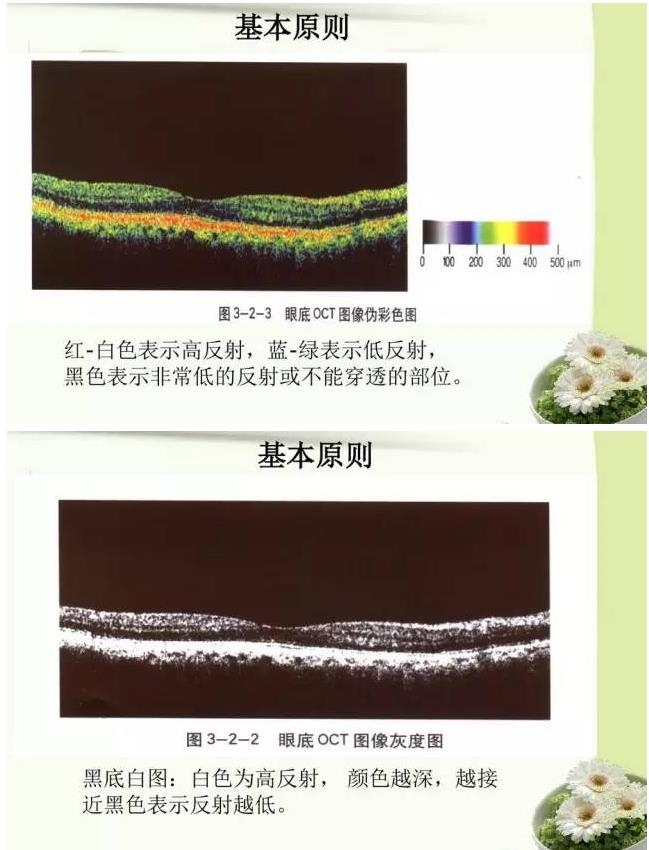 OCT����֪ʶ������֪���Ķ�������