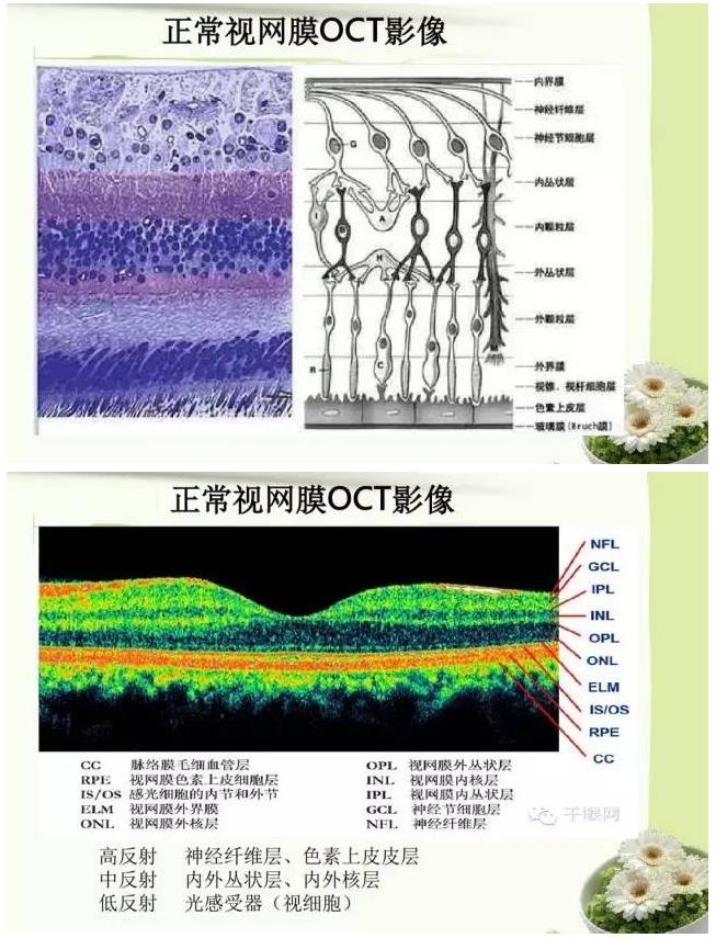 OCT����֪ʶ������֪���Ķ�������