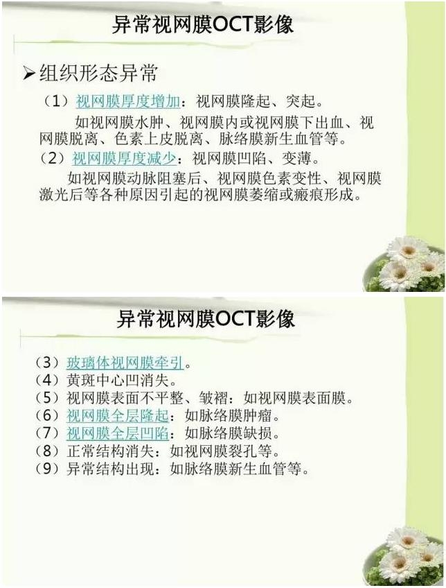 OCT����֪ʶ������֪���Ķ�������