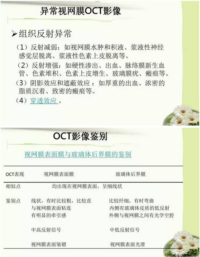 OCT����֪ʶ������֪���Ķ�������