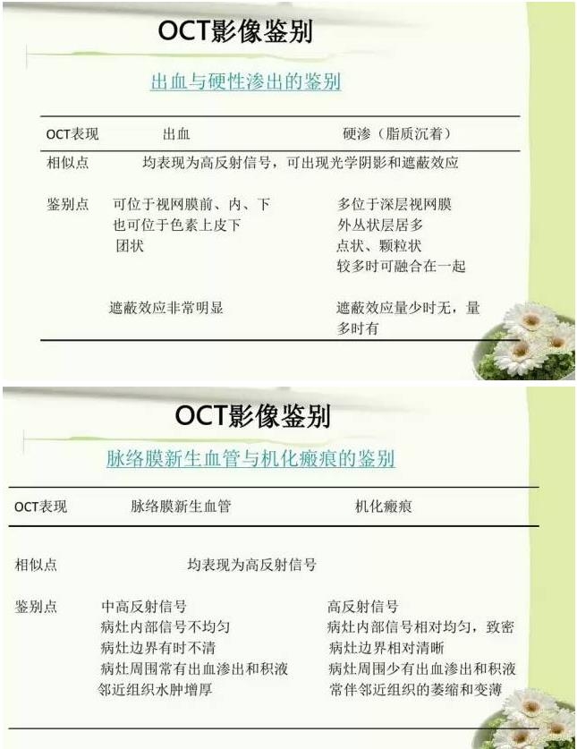 OCT����֪ʶ������֪���Ķ�������