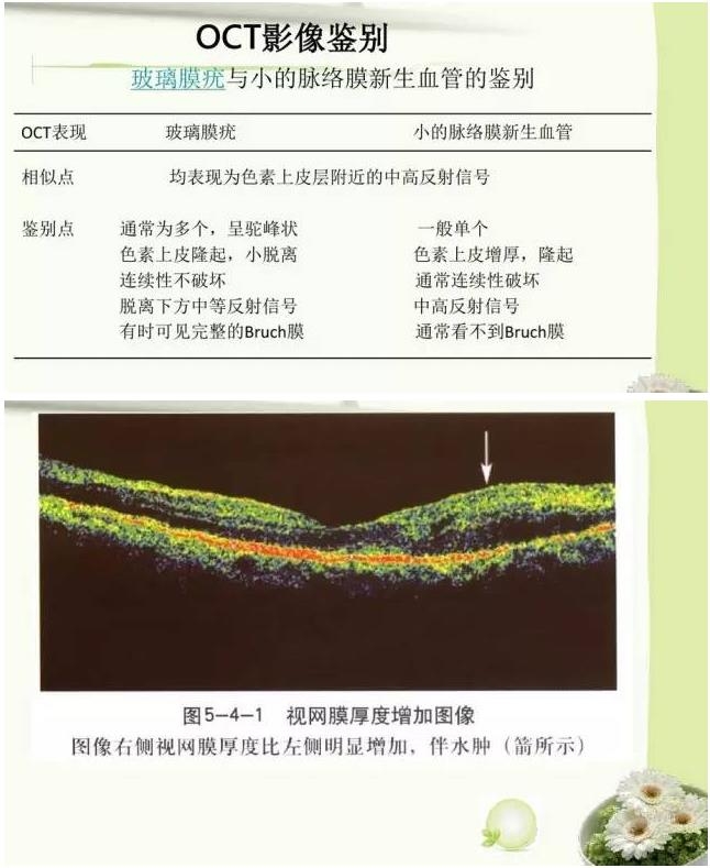 OCT����֪ʶ������֪���Ķ�������