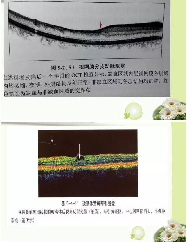 OCT����֪ʶ������֪���Ķ�������