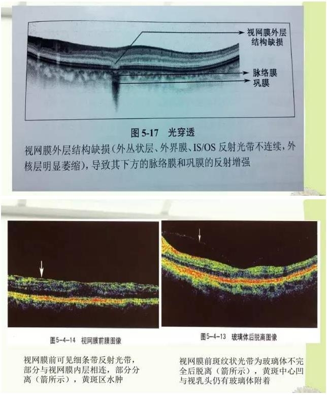 OCT����֪ʶ������֪���Ķ�������