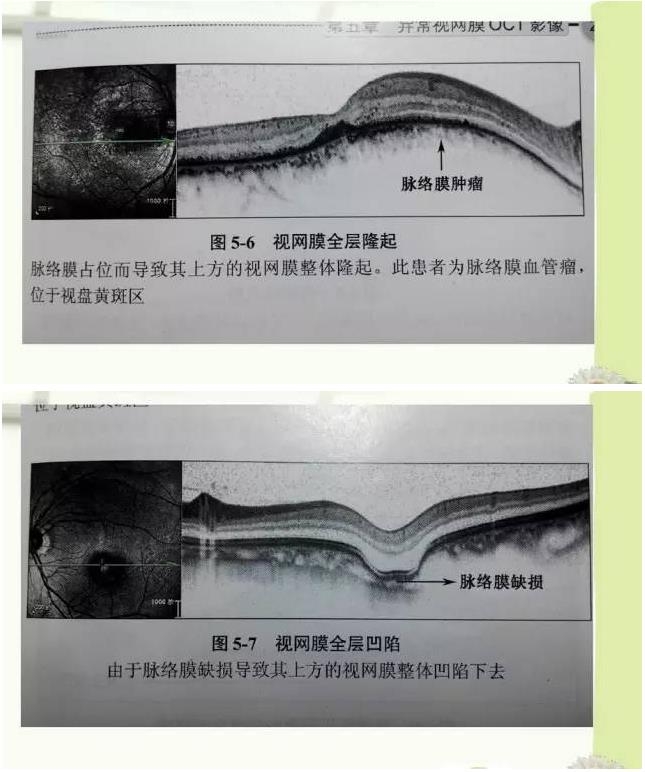 OCT����֪ʶ������֪���Ķ�������