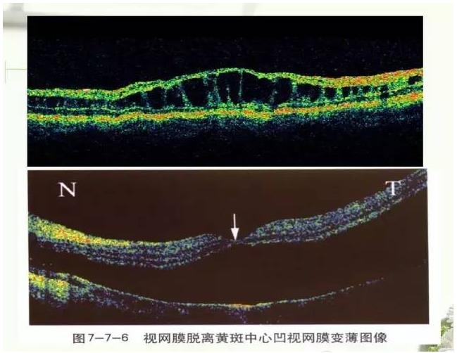 OCT����֪ʶ������֪���Ķ�������