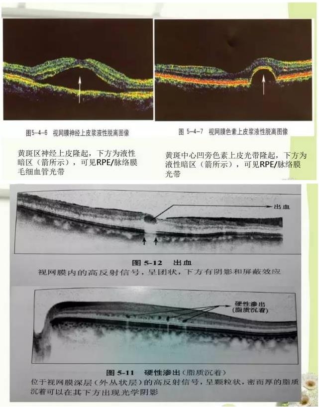 OCT����֪ʶ������֪���Ķ�������